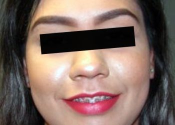 VINCULAN A PROCESO A UNA PAREJA, COMO PROBABLE RESPONSABLE DEL ROBO DE MÁS DE 1 MILLÓN DE PESOS A ESCUELA DE ENFERMERÍA EN NOGALES,