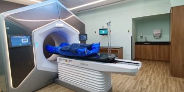 Radioterapia con IA mejora el tratamiento de cancer