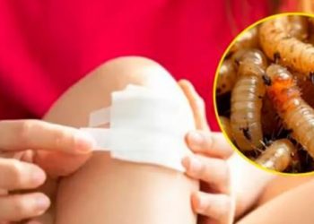 Detectan primer caso humano de gusano barrenador en EEUU, reporta Reuters.